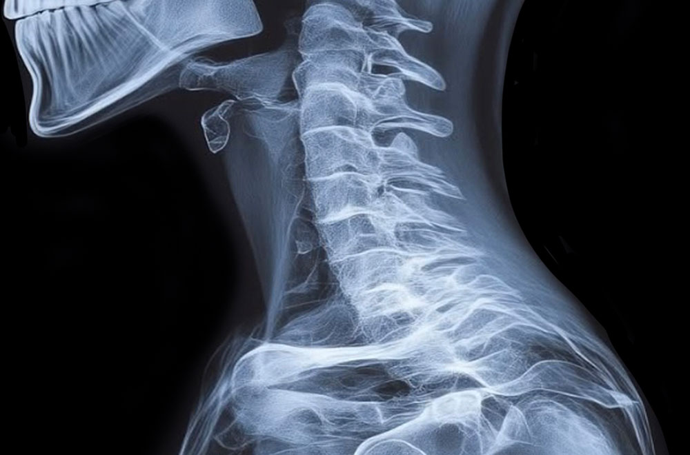 chiropractic x rays chiropractic x rays